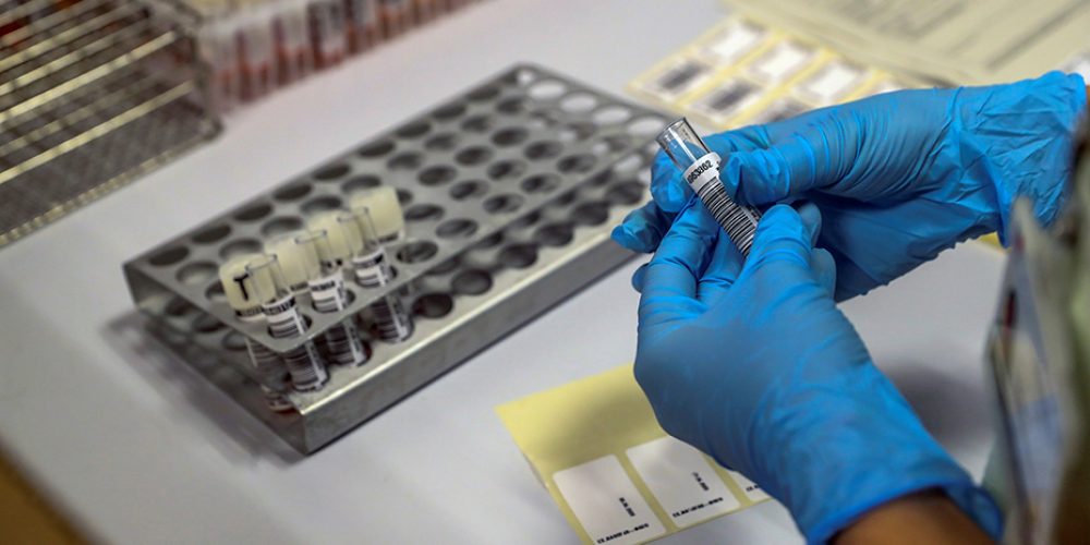 La realizará en los próximos días más de 8.500 test rápidos a los policías locales de Andalucía