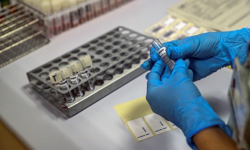 La realizará en los próximos días más de 8.500 test rápidos a los policías locales de Andalucía